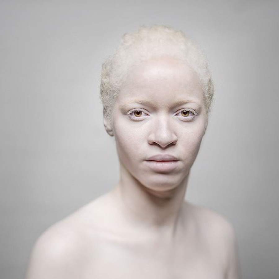 alice leveque albinos